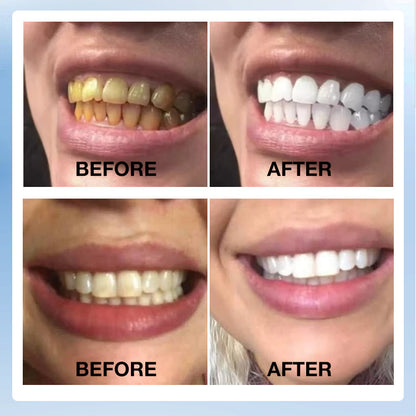 Mid-year promo Buy 1 Take 1 – 3 in 1 Stain-Removing Mouthwash -Freshens breath / Removes hidden gunk / Helps maintain white teeth - Refresh mouth in 30 seconds
